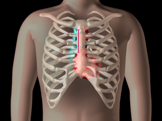 胸骨
［切開範囲］脊柱 椎間板 開胸/胸骨切開から心臓ヘ 肋骨 鎖骨 心臓手術