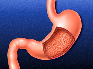 胃断面（イラスト） 消化器 噴門部 幽門部 胃体部 胃壁 粘膜層 粘膜下層 筋層 胃小窩 胃液