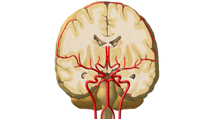 脳血管（前額断面） 前大脳動脈 中大脳動脈 脳底動脈 内頸動脈 椎骨動脈 外頸動脈 総頸動脈 脳梁辺縁動脈 脳梁動脈 後頭頂動脈 角回動脈 線条体動脈 前交通動脈 前脈絡叢動脈 後大脳動脈 大脳動脈輪 上小脳動脈 レンズ核 視床 内包 脳室 脳梁 脳弓 被殻 淡蒼球 海馬 視床下部 尾状角 線条体