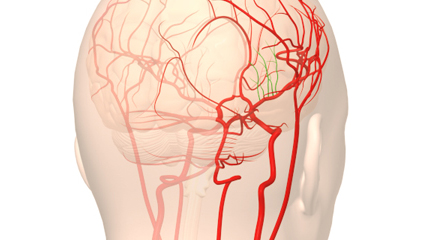 脳血管 総脛動脈 外脛動脈 内脛動脈 眼動脈 前脈絡叢動脈 中大脳動脈 前前頭頂動脈 中心前溝動脈 中心溝動脈 前頭頂動脈 後頭頂動脈 角回動脈 側頭後頭動脈 後側頭動脈 中側頭動脈 前大脳動脈 レンズ核線条体動脈 前頭極動脈 橈骨動脈 脳梁周囲動脈 椎骨脳底動脈 椎骨動脈 脳底動脈 後下小脳動脈 上小脳動脈 前下小脳動脈 後大脳動脈 後側頭動脈 鳥距動脈 頭頂後頭動脈 視床穿通動脈 前交通動脈 後交通動脈 ウイルス動脈輪