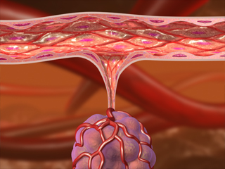 がんによる血管新生 がん細胞 転移 血管内皮細胞 増殖因子 増殖 毛細血管 細胞増殖因子受容体 シグナル伝達 がん細胞栄養源